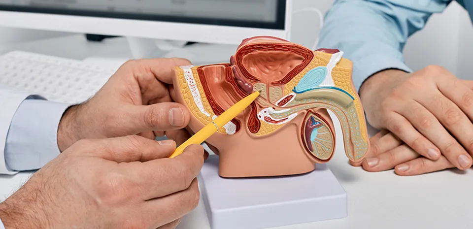 A physician inspects a human organ model, highlighting aspects relevant to prostate cancer diagnosis and treatment.